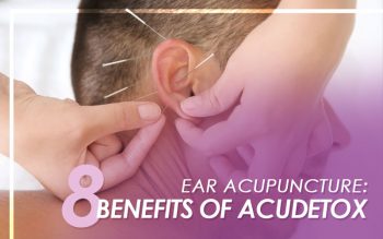 Ear Acupuncture 8 Benefits of Acudetox